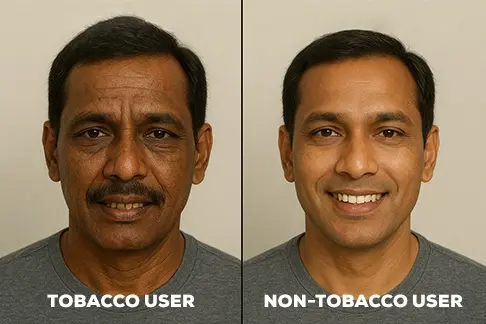 tobacco users vs non tobacco users look